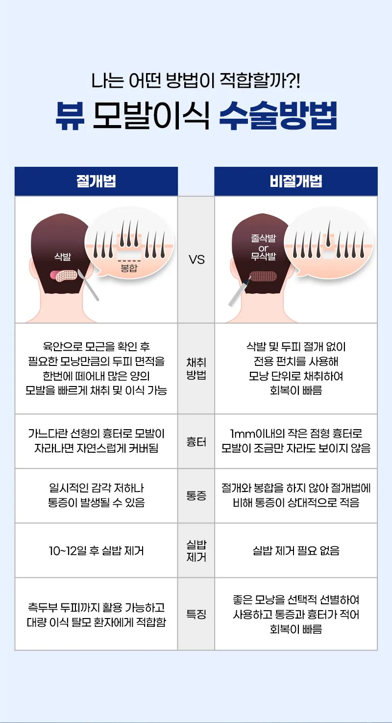 뷰성형외과 ❤뷰❤모발이식 이벤트, 시술 상세 이미지