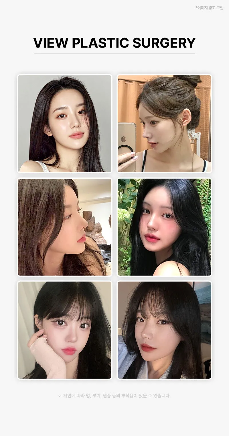 뷰성형외과 ❤뷰❤중안면 수직 리프팅 이벤트, 시술 상세 이미지