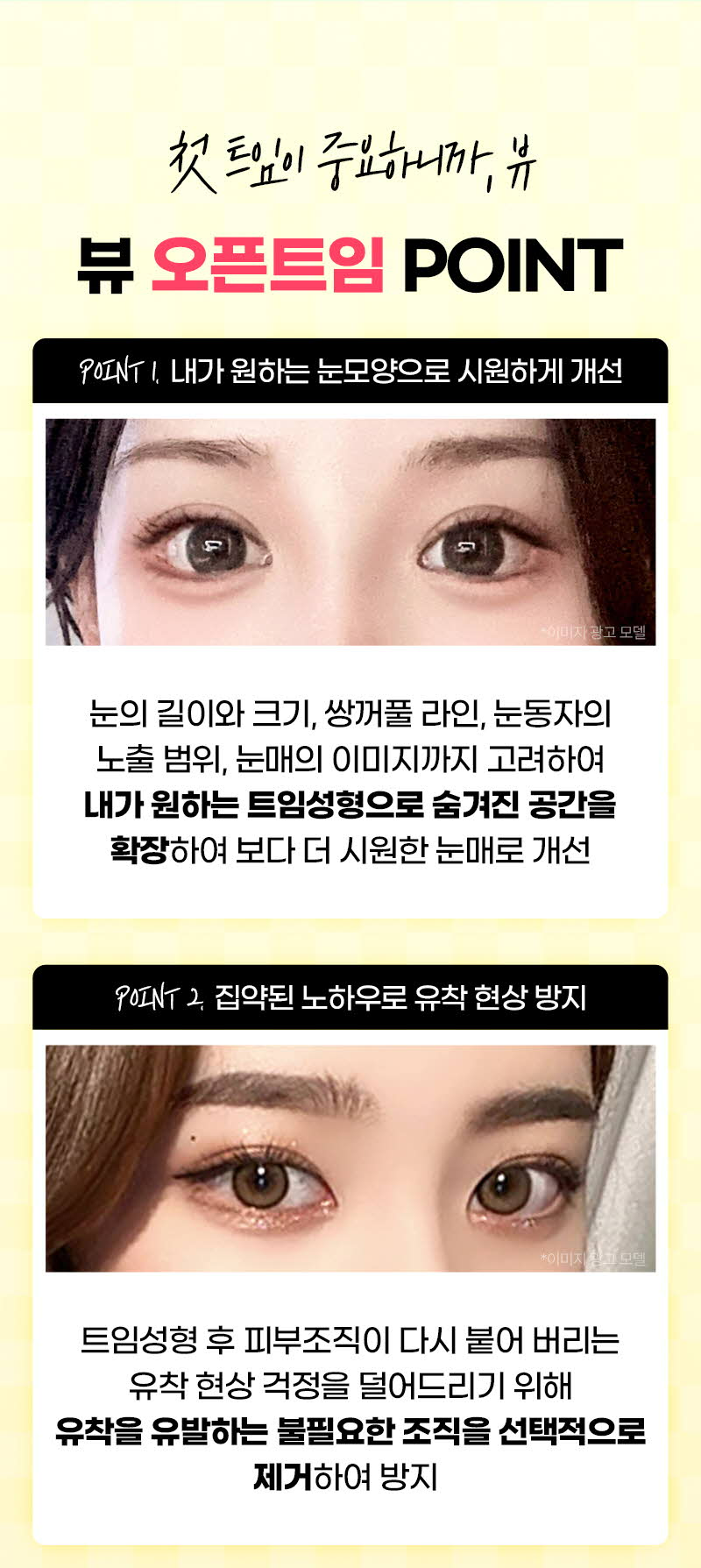 뷰성형외과 ❤️뷰❤️오픈 트임  이벤트, 시술 상세 이미지