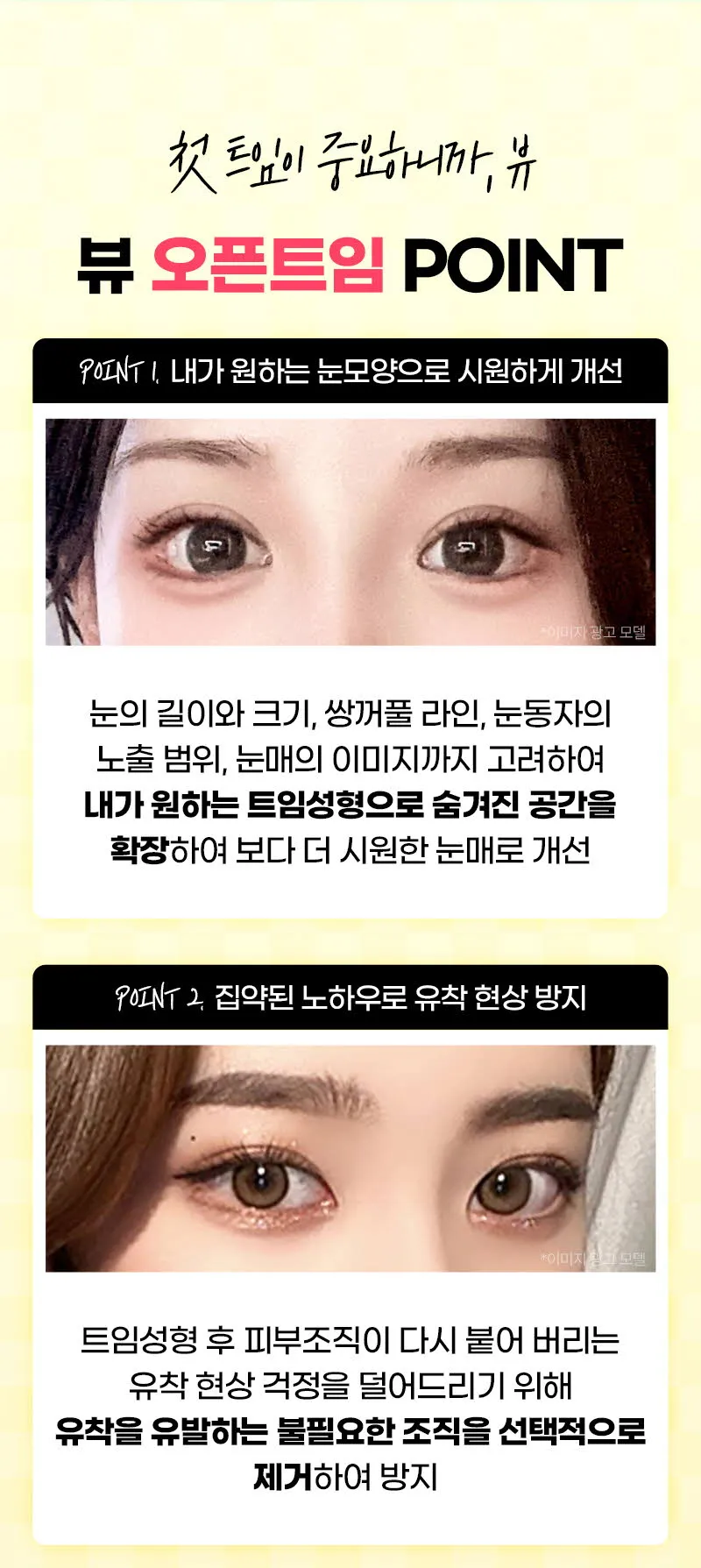 뷰성형외과 ❤️뷰❤️오픈 트임 이벤트, 시술 상세 이미지