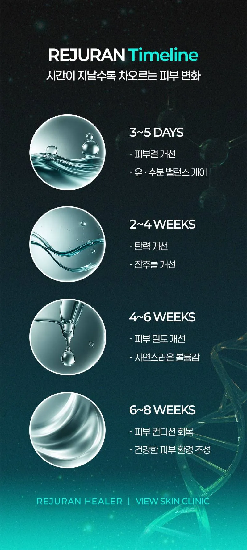 뷰성형외과 ❤️뷰❤️리쥬란힐러 4cc 이벤트, 시술 상세 이미지