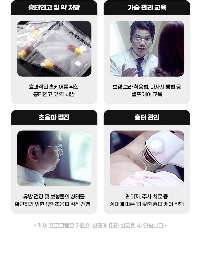 뷰성형외과 ❤️뷰❤️UIU 멘토 엑스트라 이벤트, 시술 상세 이미지