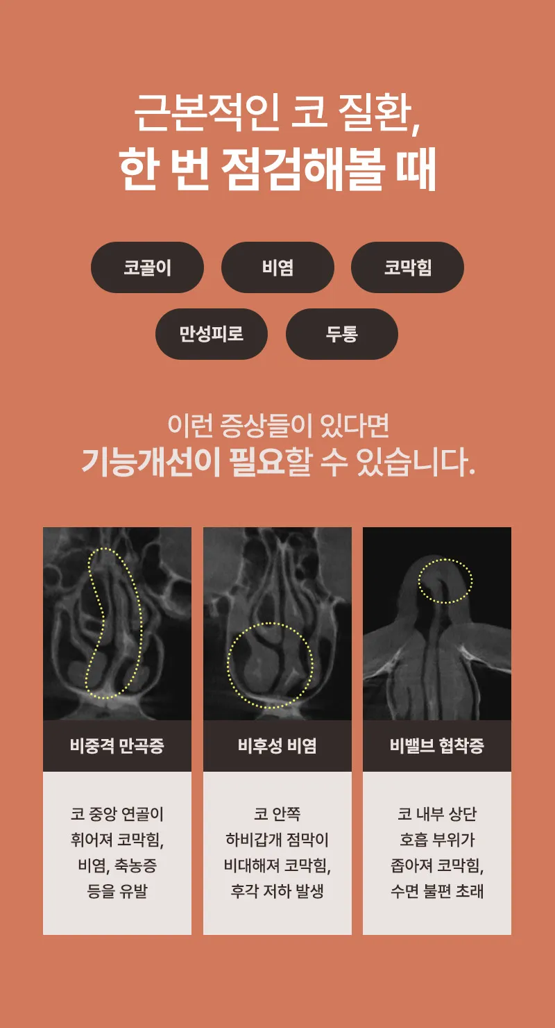 뷰성형외과 ❤️뷰❤️기능코성형 이벤트, 시술 상세 이미지