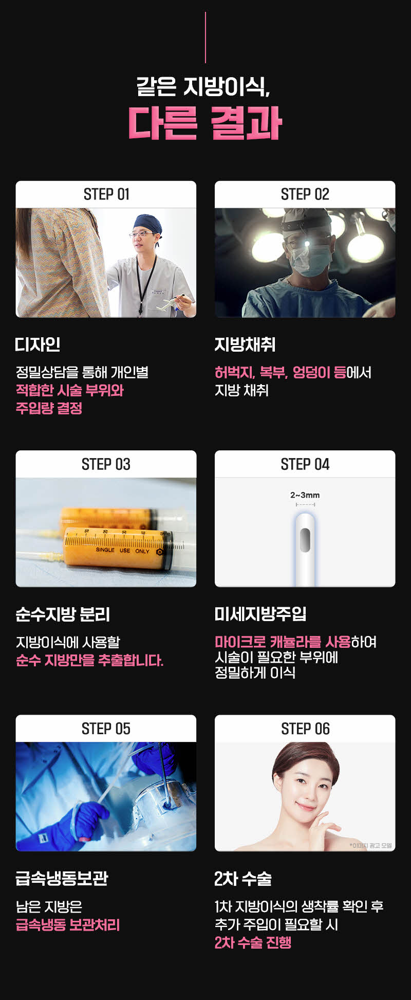 뷰성형외과 ❤️뷰❤️얼굴 지방이식 이벤트, 시술 상세 이미지