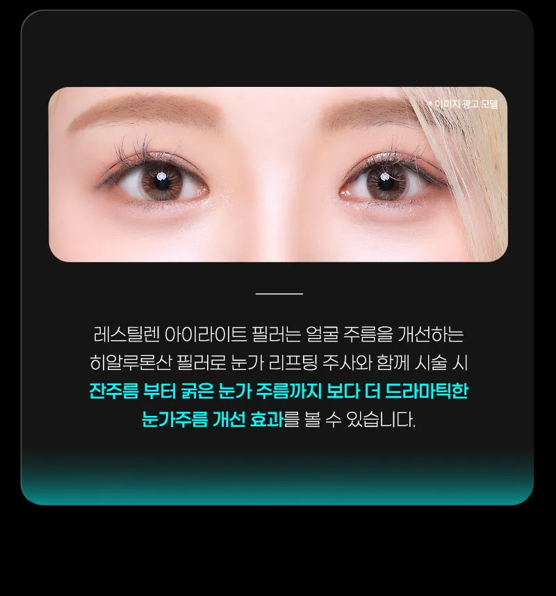 뷰성형외과 ❤️뷰❤️ 아이리프팅 이벤트, 시술 상세 이미지