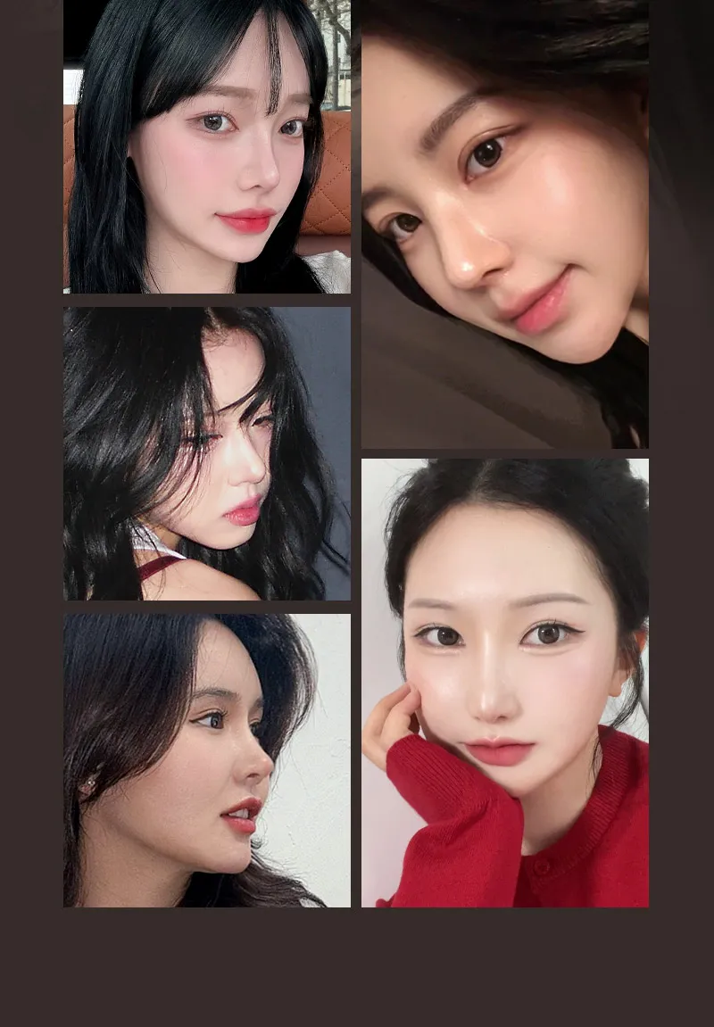 뷰성형외과 ❤️뷰❤️기능코성형 이벤트, 시술 상세 이미지