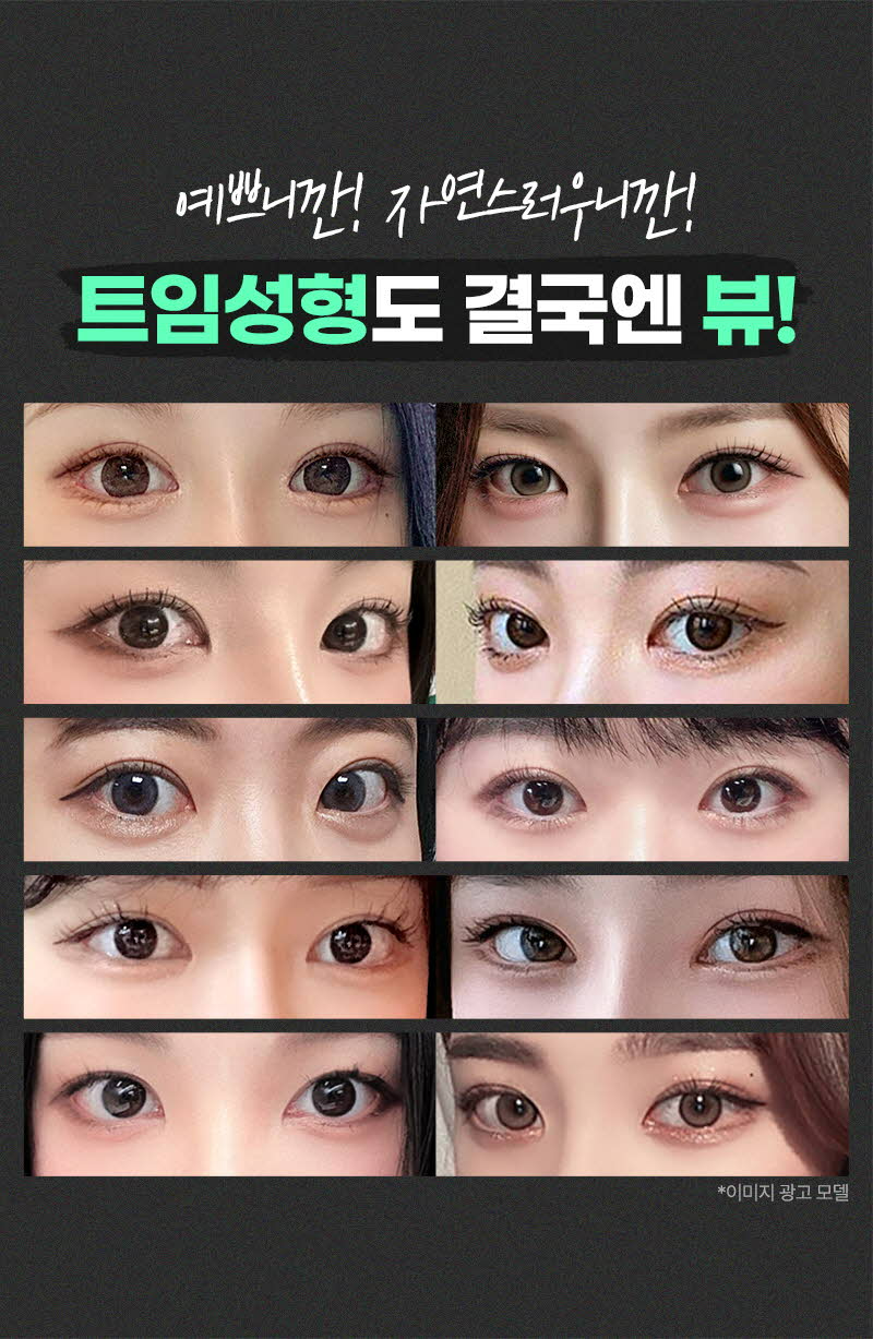 뷰성형외과 ❤️뷰❤️오픈 트임  이벤트, 시술 상세 이미지