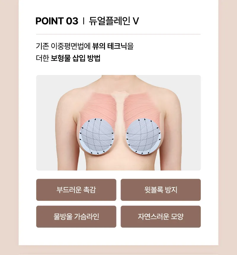 뷰성형외과 ❤뷰❤여의사 UIU 가슴성형 이벤트, 시술 상세 이미지