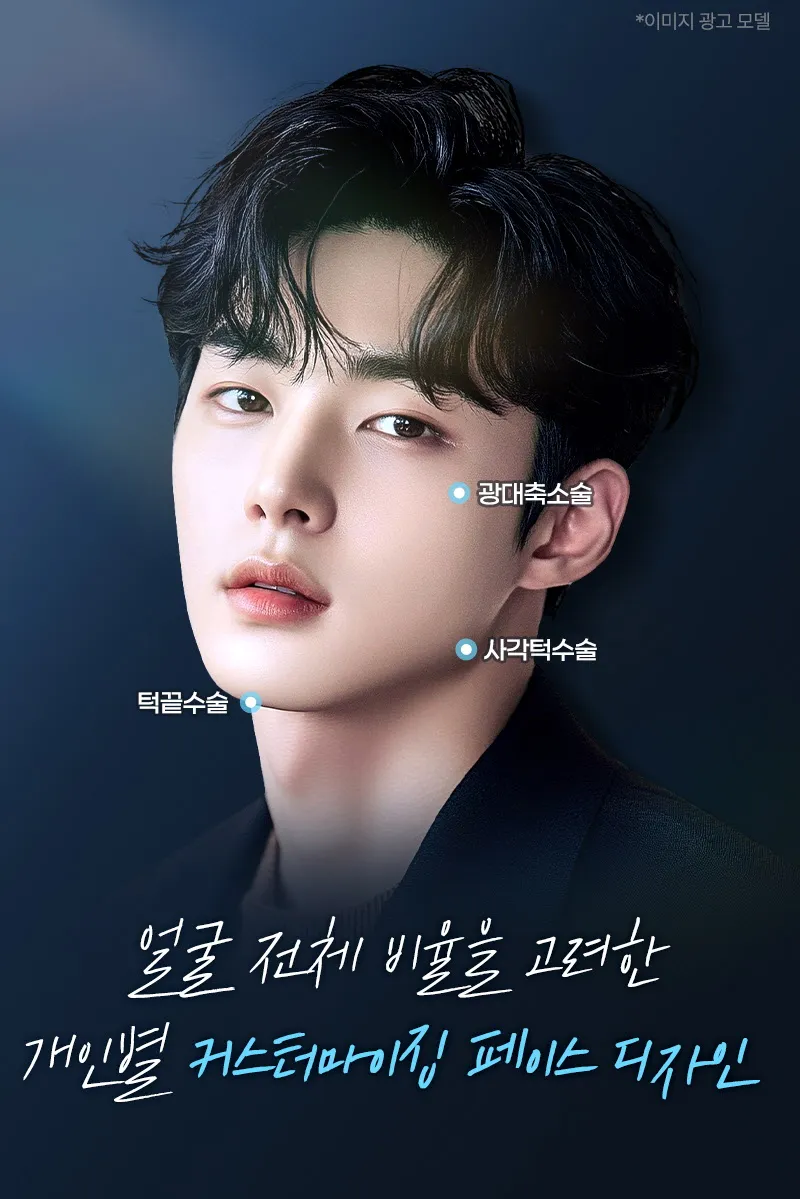 뷰성형외과 ❤️뷰❤️남자 안면윤곽 이벤트, 시술 상세 이미지
