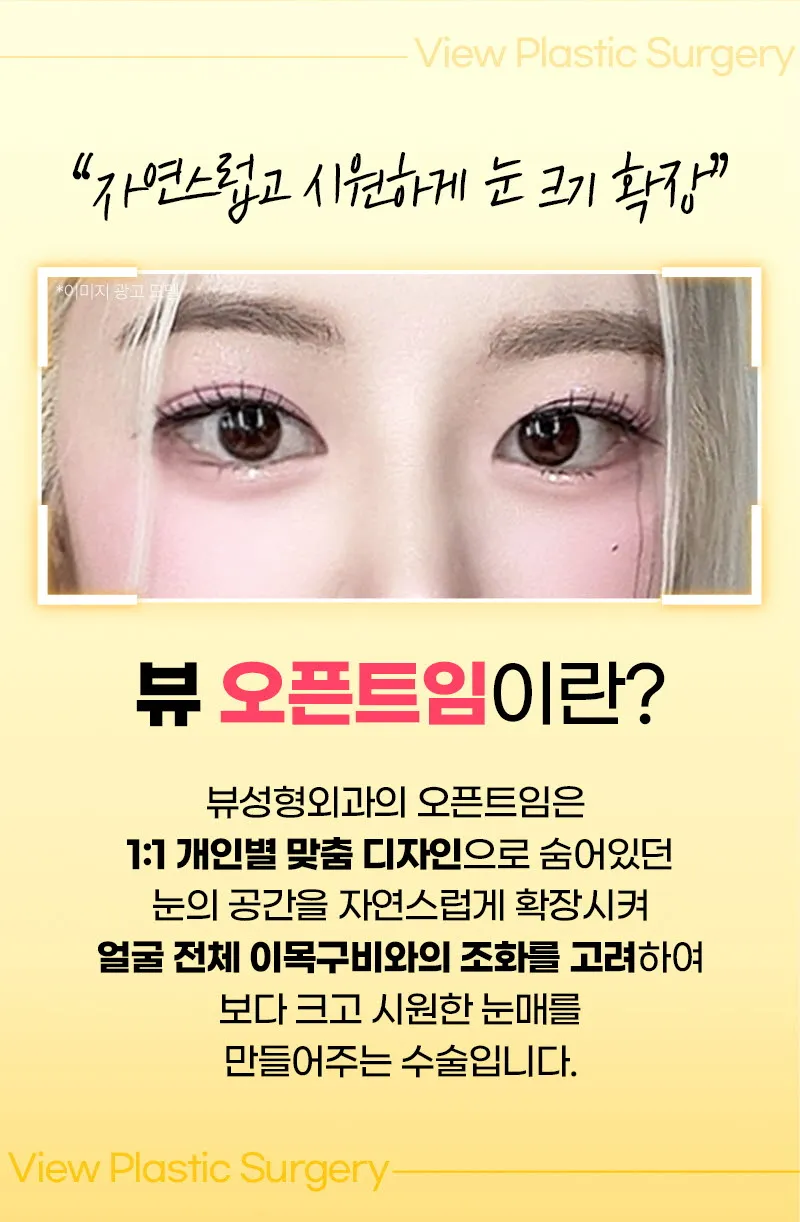 뷰성형외과 ❤️뷰❤️오픈 트임 이벤트, 시술 상세 이미지
