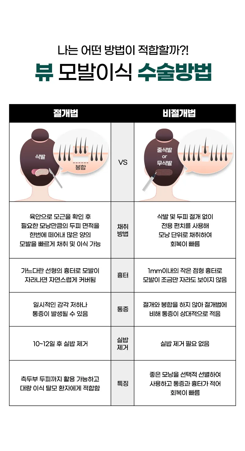뷰성형외과 ❤뷰❤헤어라인 모발이식 이벤트, 시술 상세 이미지