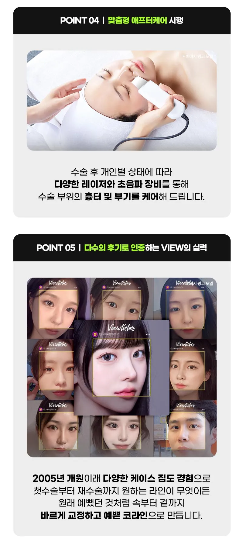 뷰성형외과 ❤️뷰❤️코재수술 이벤트, 시술 상세 이미지