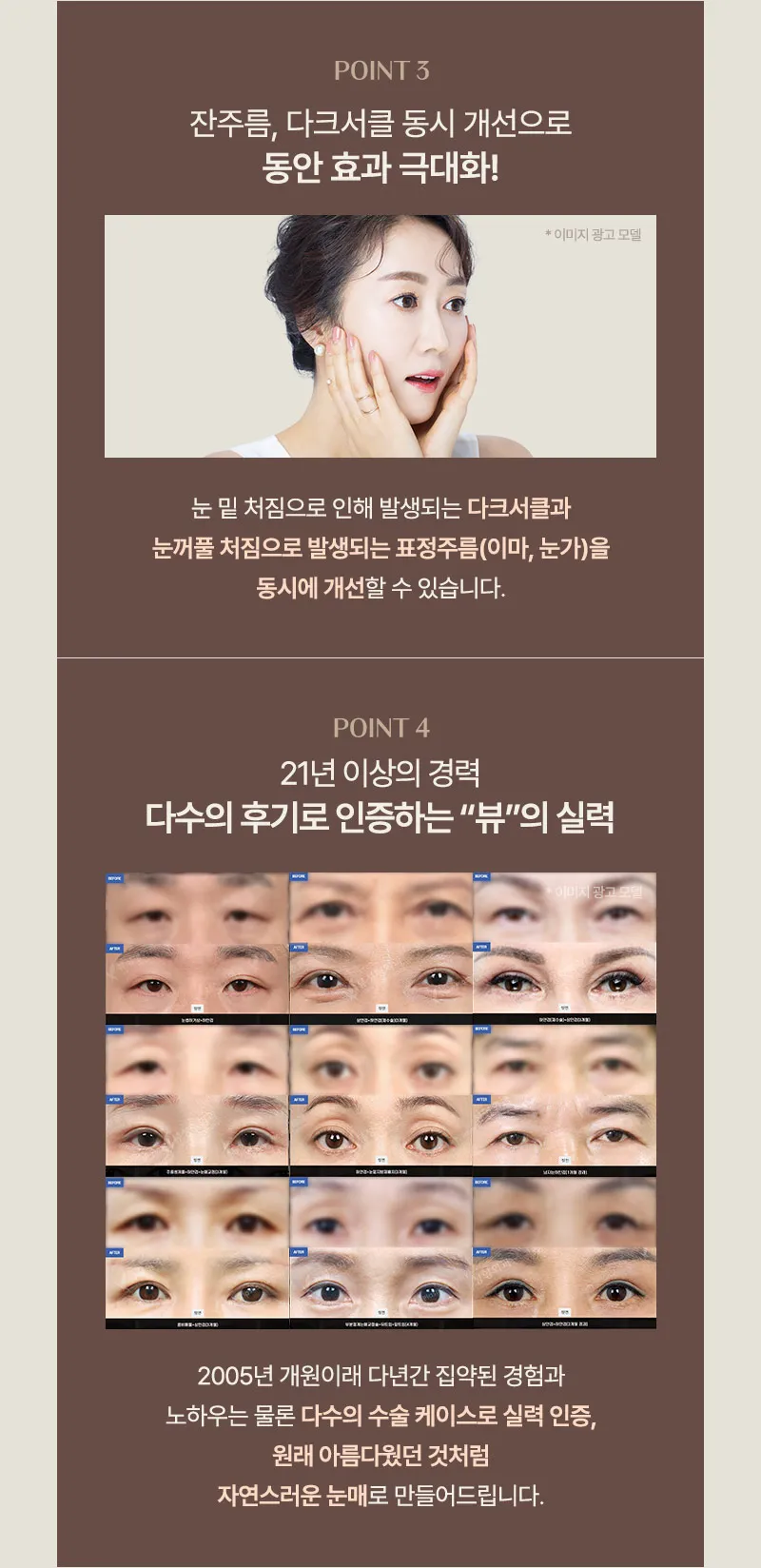 ❤️뷰❤️중년 눈성형