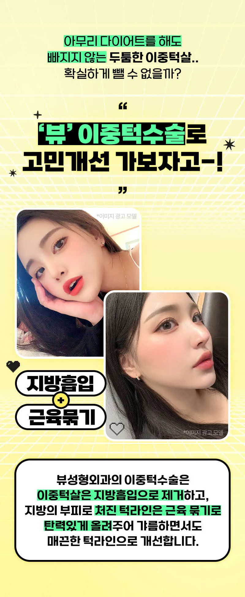 뷰성형외과 ❤뷰❤얼굴 지방흡입 이벤트, 시술 상세 이미지