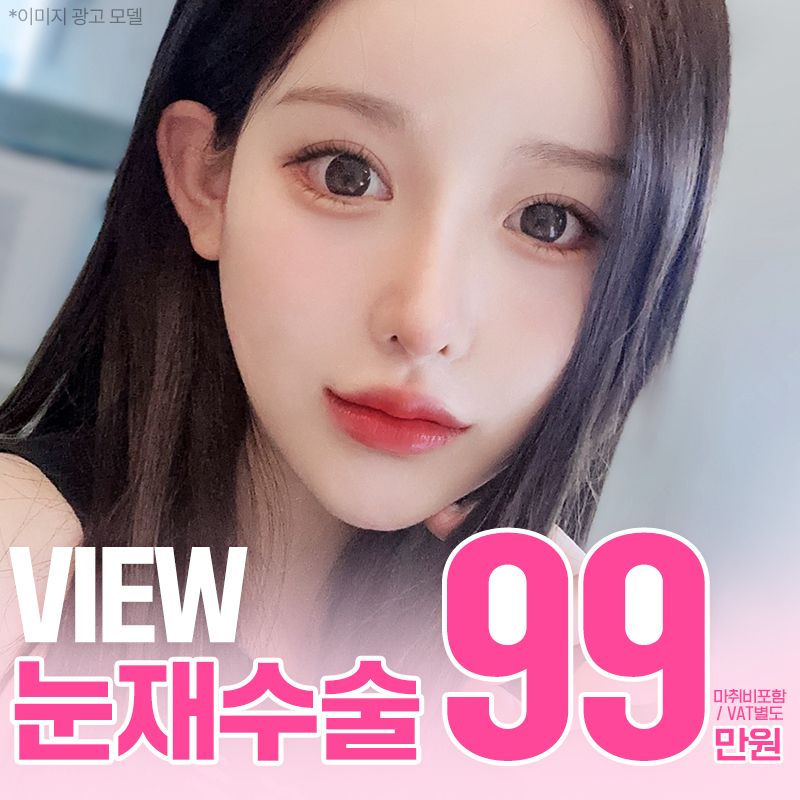 ❤️뷰❤️눈재수술 이벤트 썸네일 이미지