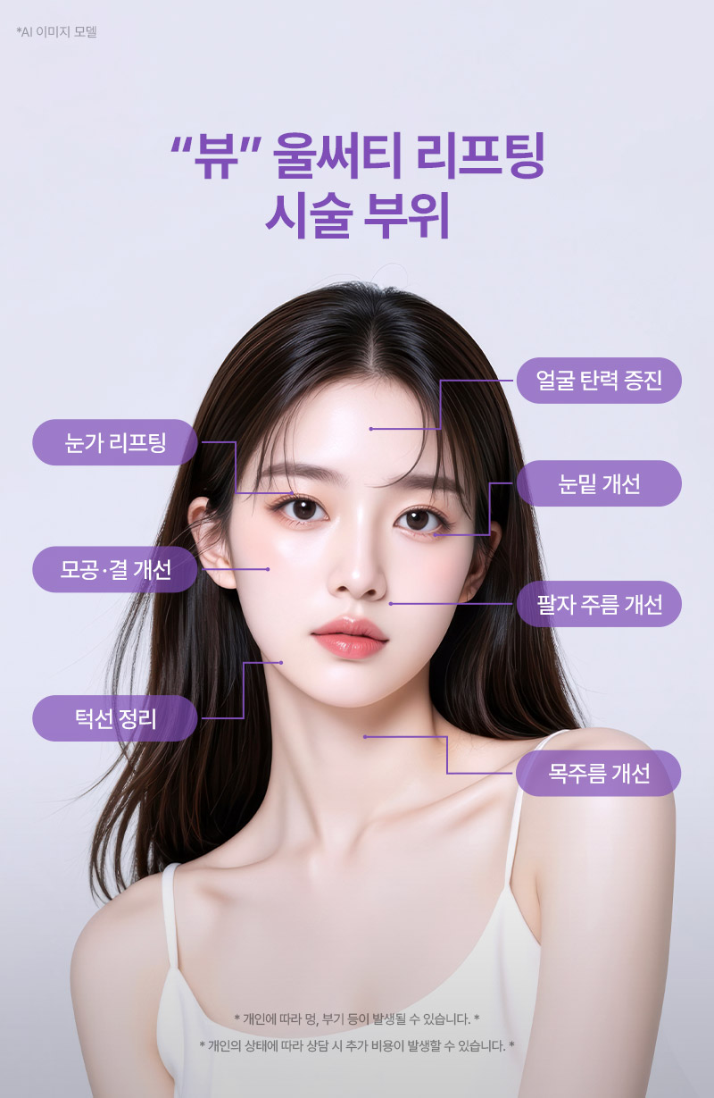 뷰성형외과 ❤뷰❤울써티리프팅 (수면마취) 이벤트, 시술 상세 이미지