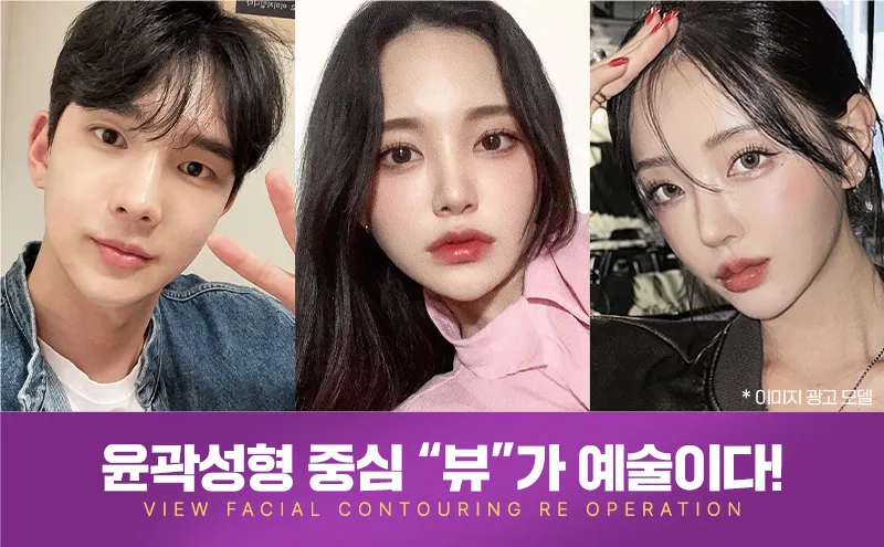 뷰성형외과 ❤️뷰❤️안면윤곽 재수술 이벤트, 시술 상세 이미지