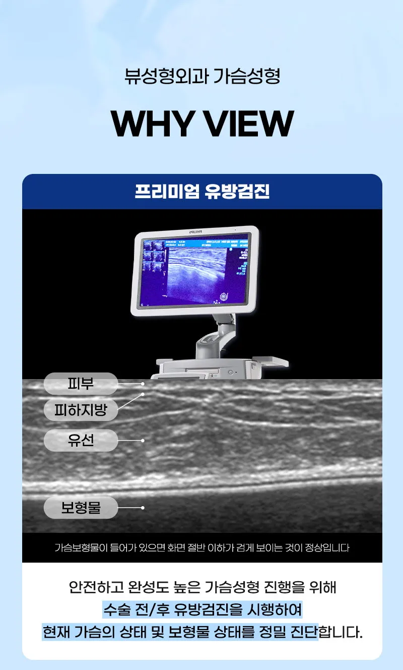뷰성형외과 ❤️뷰❤️멘토 가슴성형 이벤트, 시술 상세 이미지