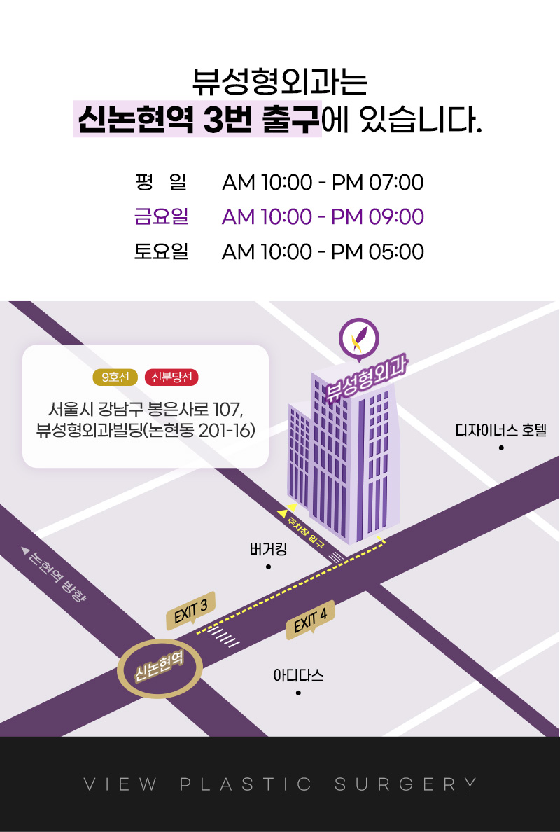 뷰성형외과 ❤️뷰❤️오픈 트임  이벤트, 시술 상세 이미지