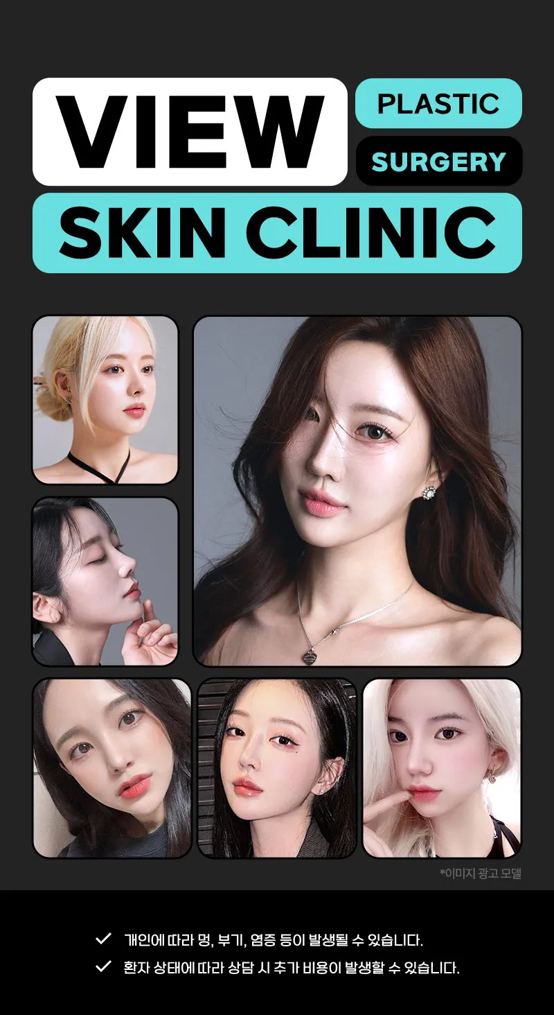 뷰성형외과 ❤️뷰❤️ 아이리프팅 이벤트, 시술 상세 이미지