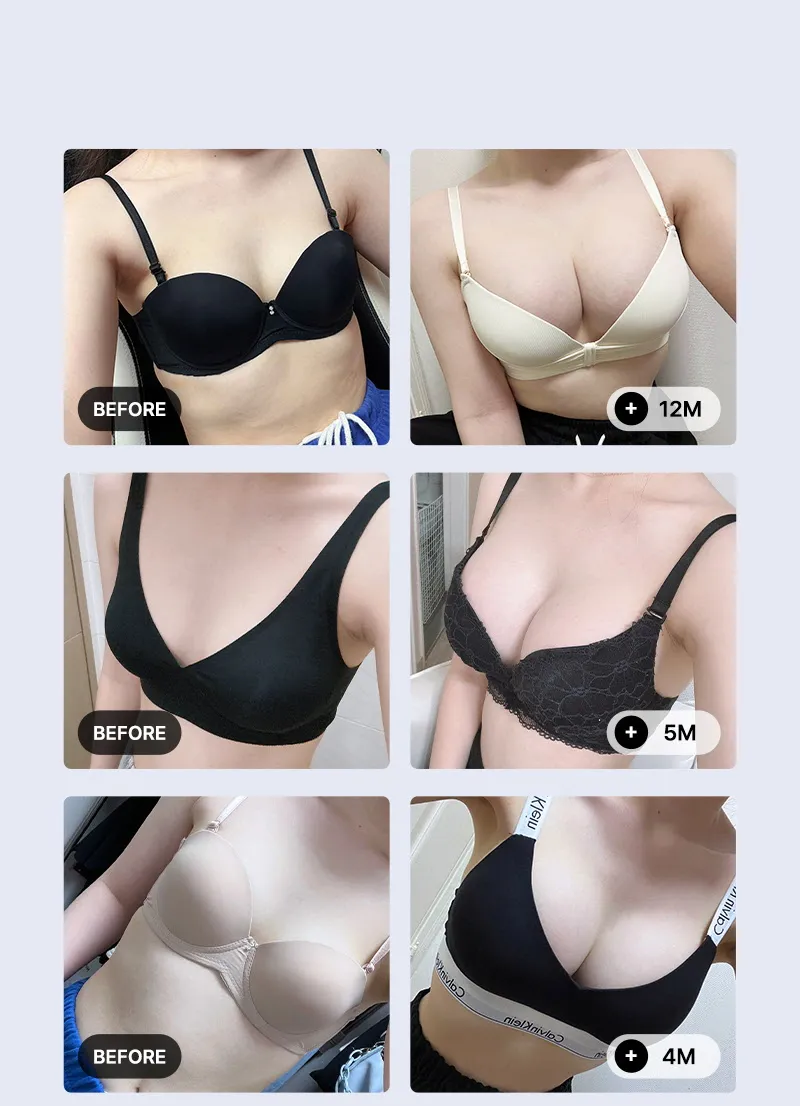 뷰성형외과 ❤️뷰❤️UIU 멘토 엑스트라 이벤트, 시술 상세 이미지