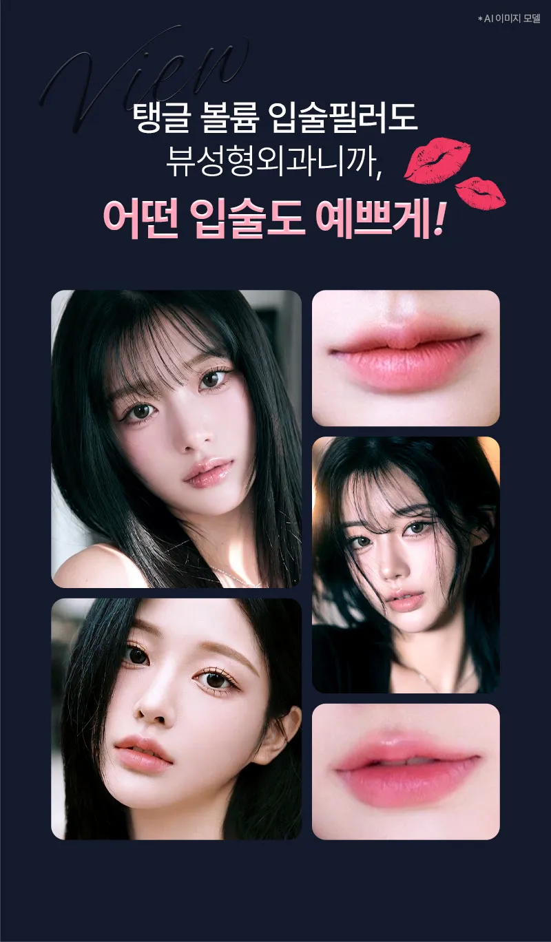 뷰성형외과 ❤뷰❤레스틸렌 입술필러, 입꼬리필러 이벤트, 시술 상세 이미지