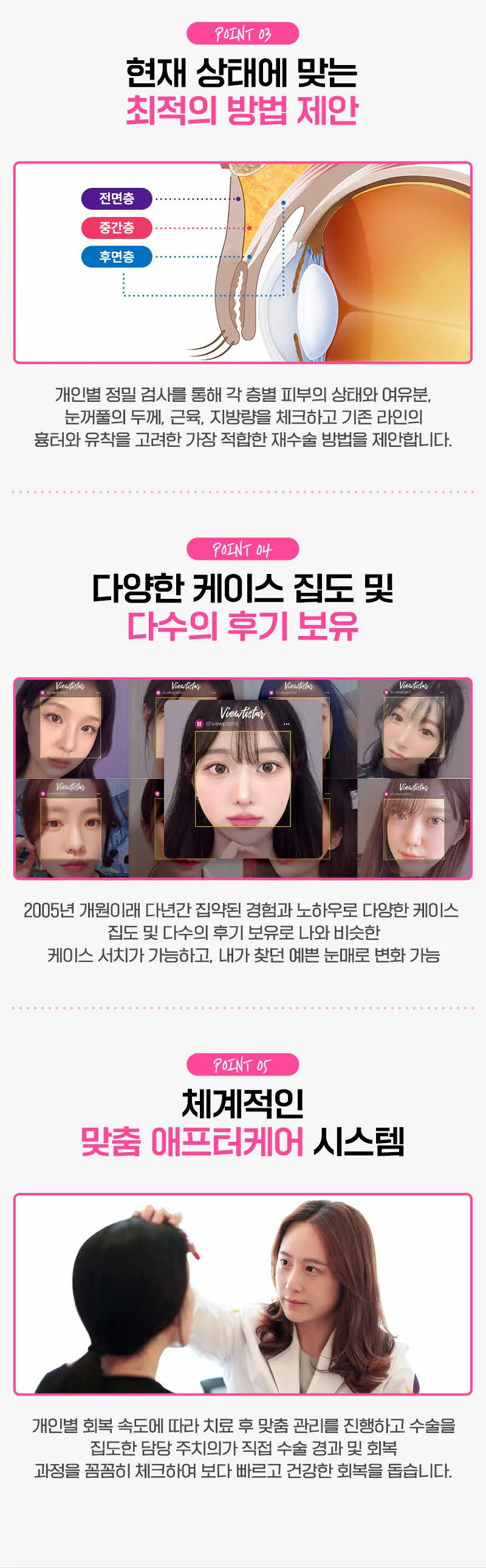 뷰성형외과 ❤️뷰❤️눈재수술 이벤트, 시술 상세 이미지