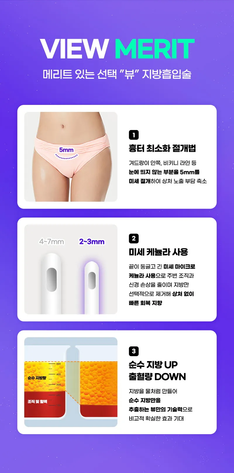 뷰성형외과 ❤️뷰❤️대용량 지방흡입 이벤트, 시술 상세 이미지