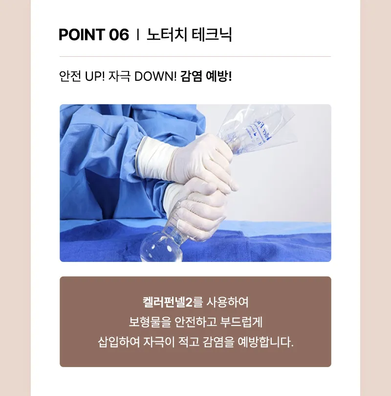 뷰성형외과 ❤뷰❤여의사 UIU 가슴성형 이벤트, 시술 상세 이미지