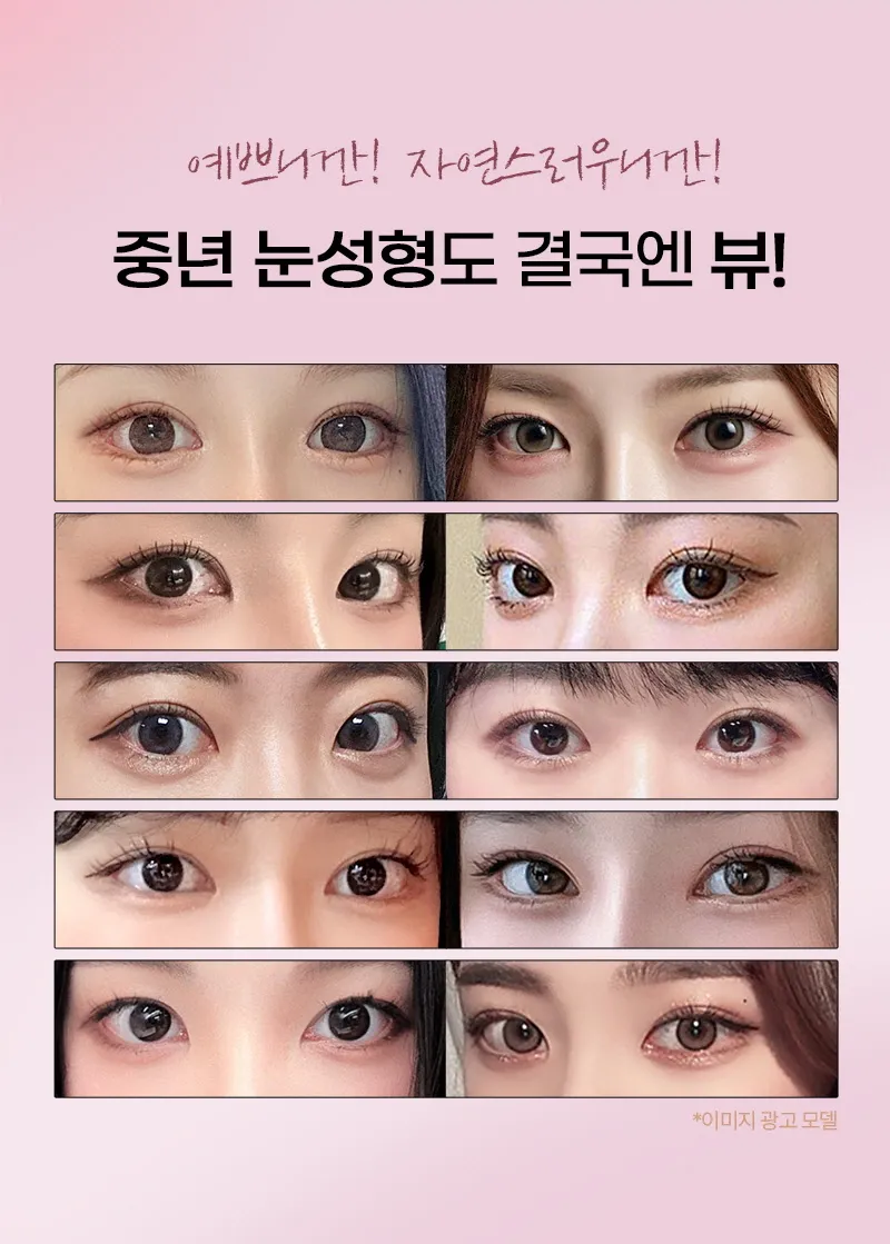 뷰성형외과 ❤️뷰❤️중년 눈성형 이벤트, 시술 상세 이미지