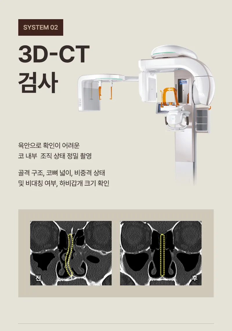 ❤️뷰❤️기능코성형