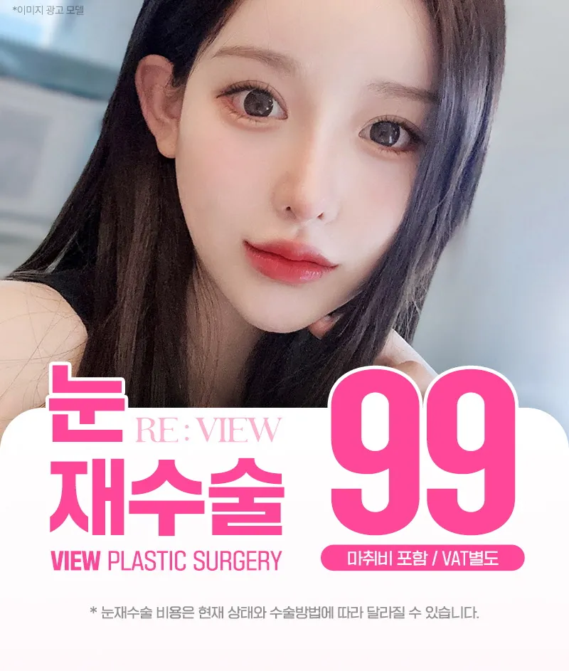 뷰성형외과 ❤️뷰❤️눈재수술 이벤트, 시술 상세 이미지