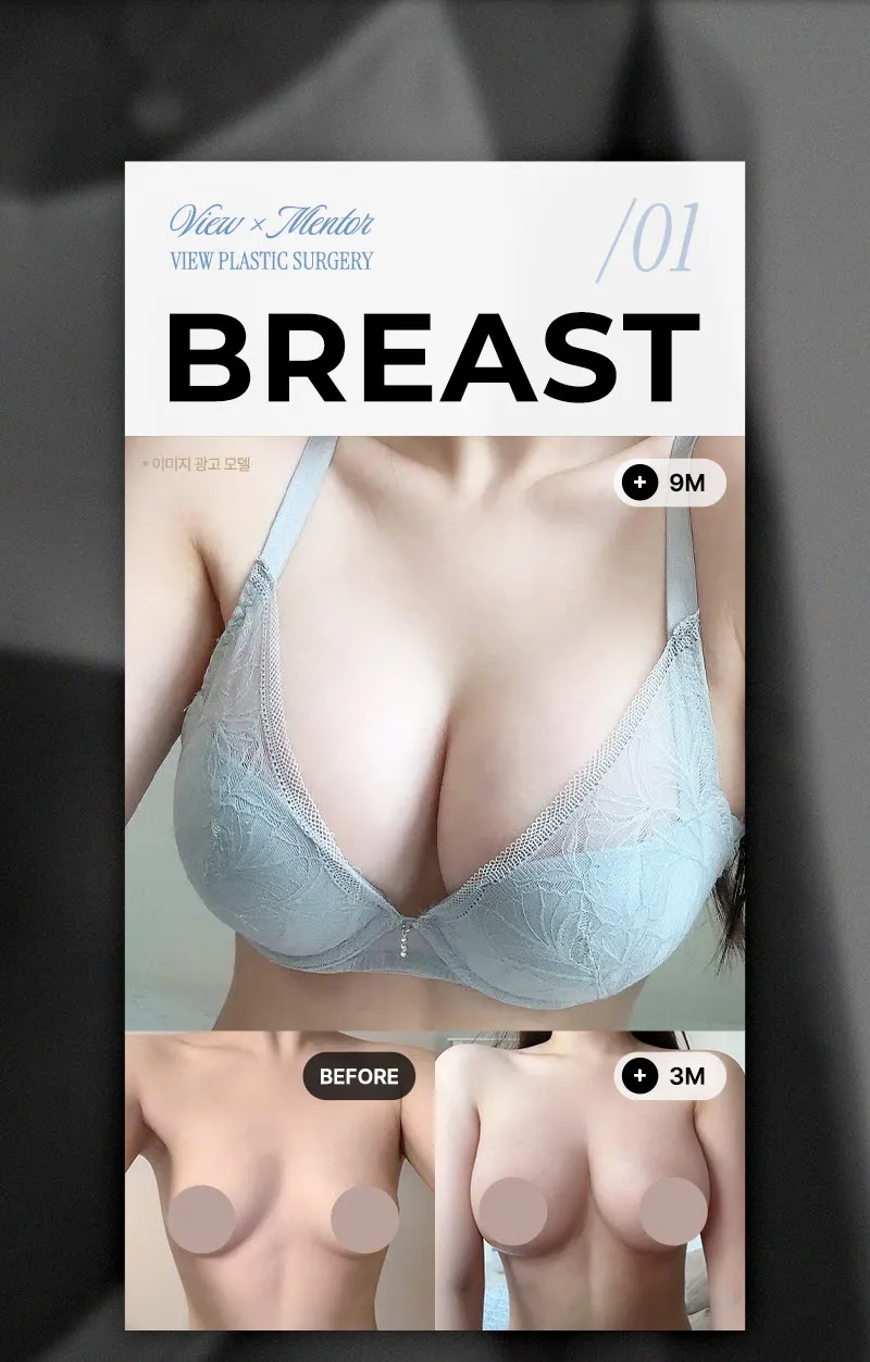 뷰성형외과 ❤️뷰❤️UIU 멘토 엑스트라 이벤트, 시술 상세 이미지