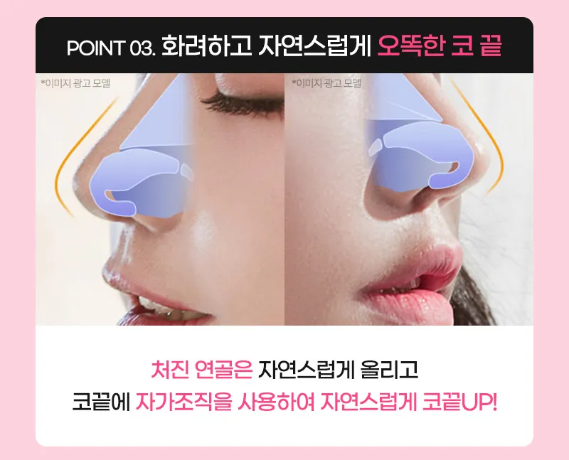 뷰성형외과 ❤️뷰❤️매부리코성형 이벤트, 시술 상세 이미지