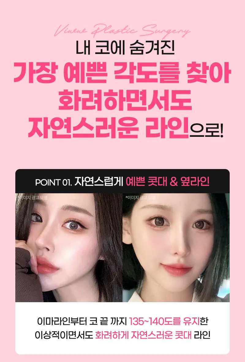 뷰성형외과 ❤️뷰❤️매부리코성형 이벤트, 시술 상세 이미지