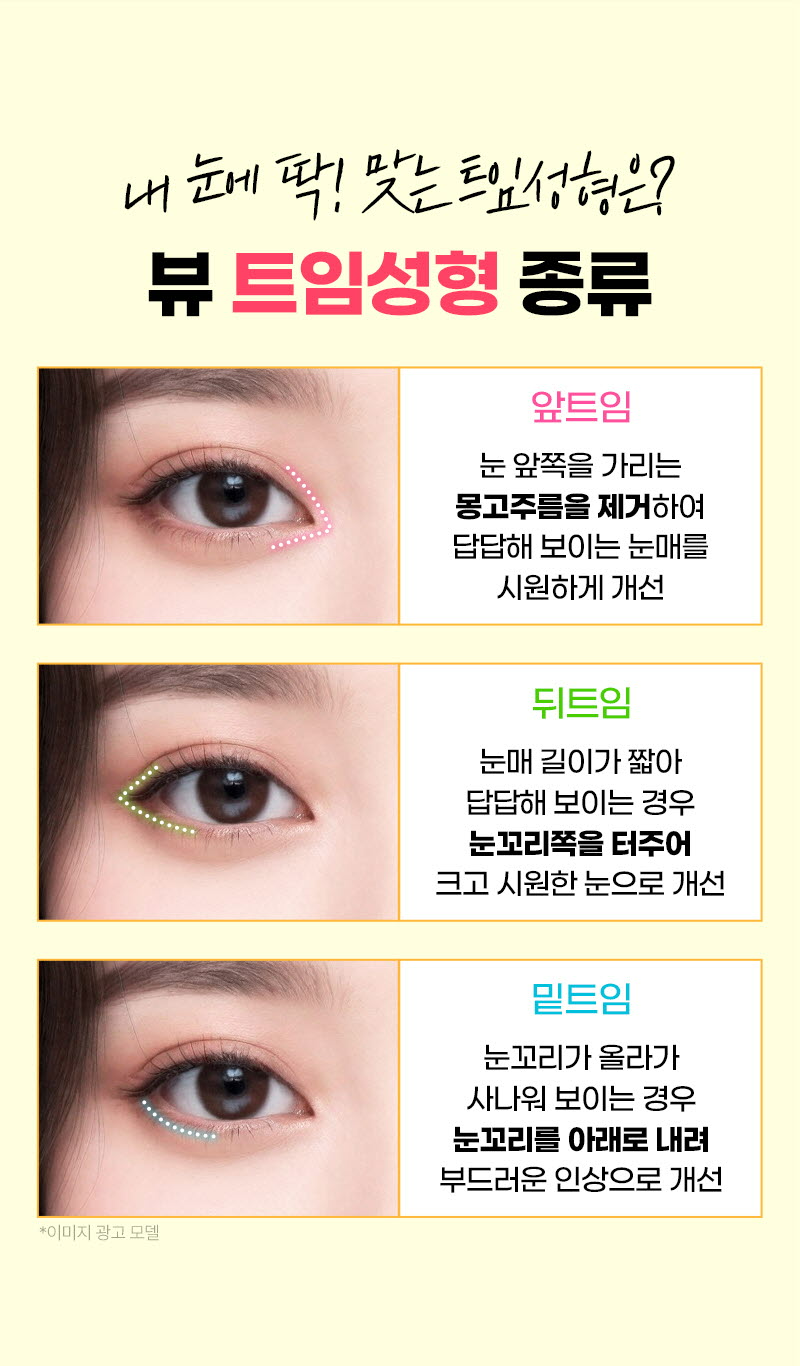 뷰성형외과 ❤️뷰❤️오픈 트임  이벤트, 시술 상세 이미지