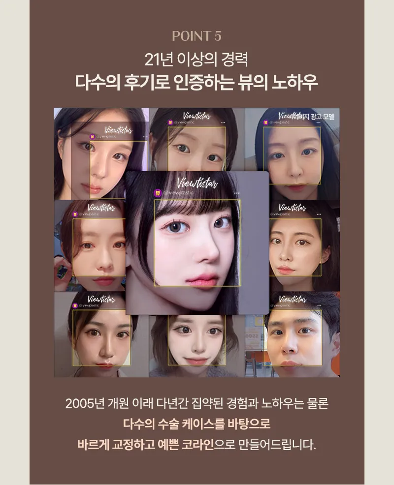 ❤️뷰❤️기능코성형