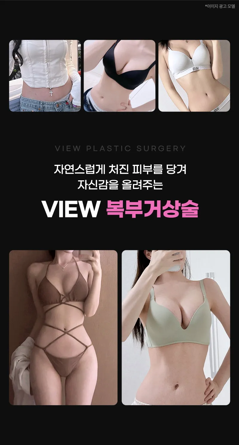 뷰성형외과 ❤뷰❤복부거상술 이벤트, 시술 상세 이미지