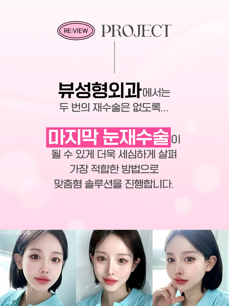 뷰성형외과 ❤️뷰❤️눈재수술 이벤트, 시술 상세 이미지