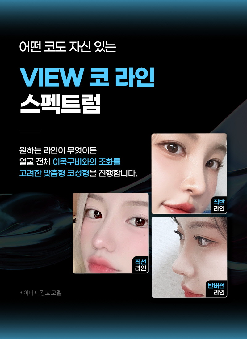 뷰성형외과 ❤️뷰❤️코성형 이벤트, 시술 상세 이미지