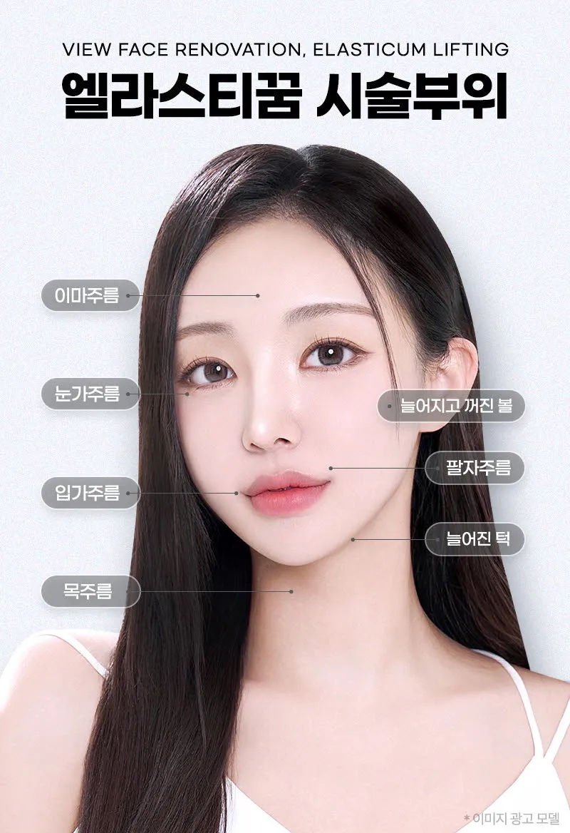 뷰성형외과 ❤뷰❤엘라스티꿈 실리프팅 이벤트, 시술 상세 이미지
