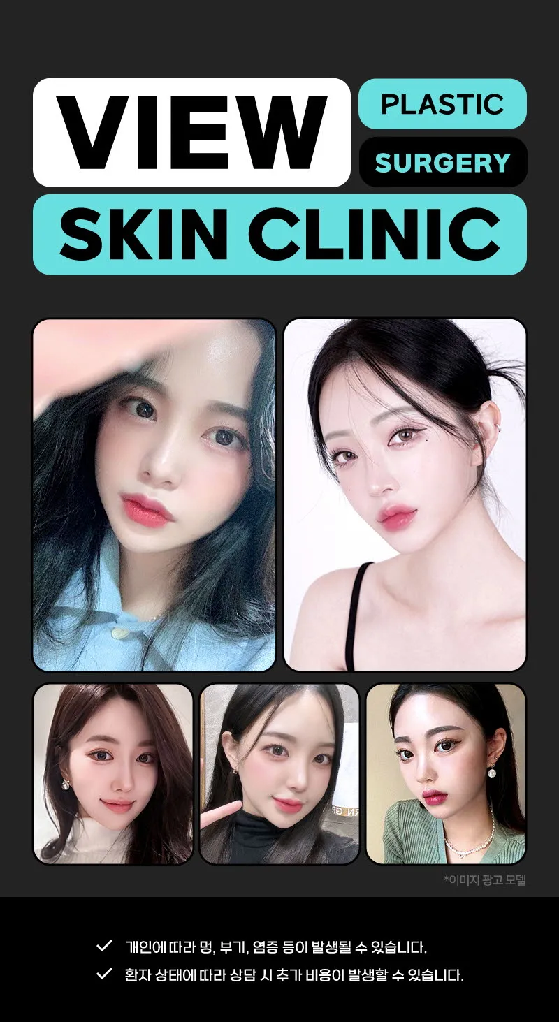 뷰성형외과 ❤️뷰❤️리쥬란힐러 4cc 이벤트, 시술 상세 이미지