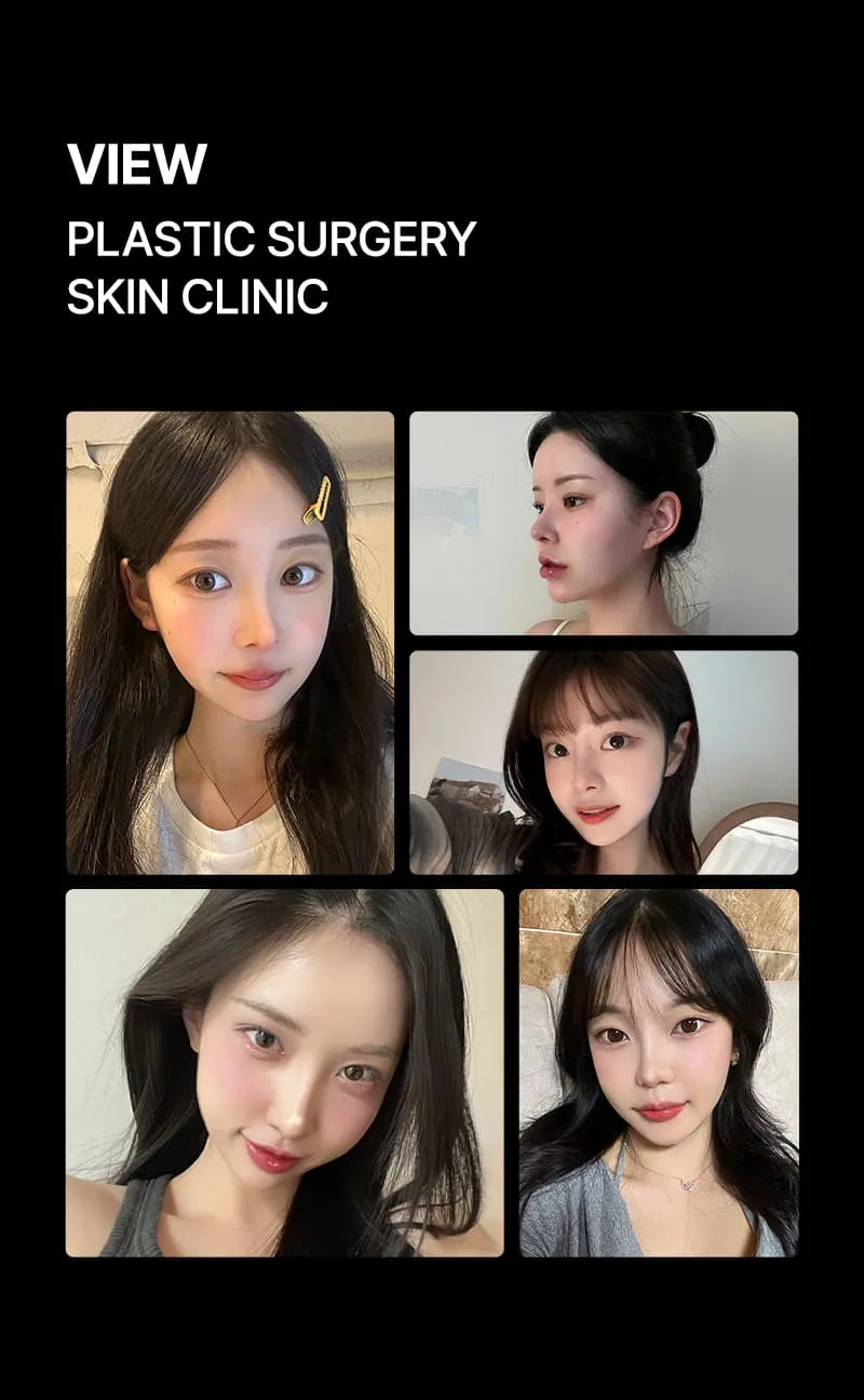 뷰성형외과 ❤뷰❤윤곽주사 이벤트, 시술 상세 이미지