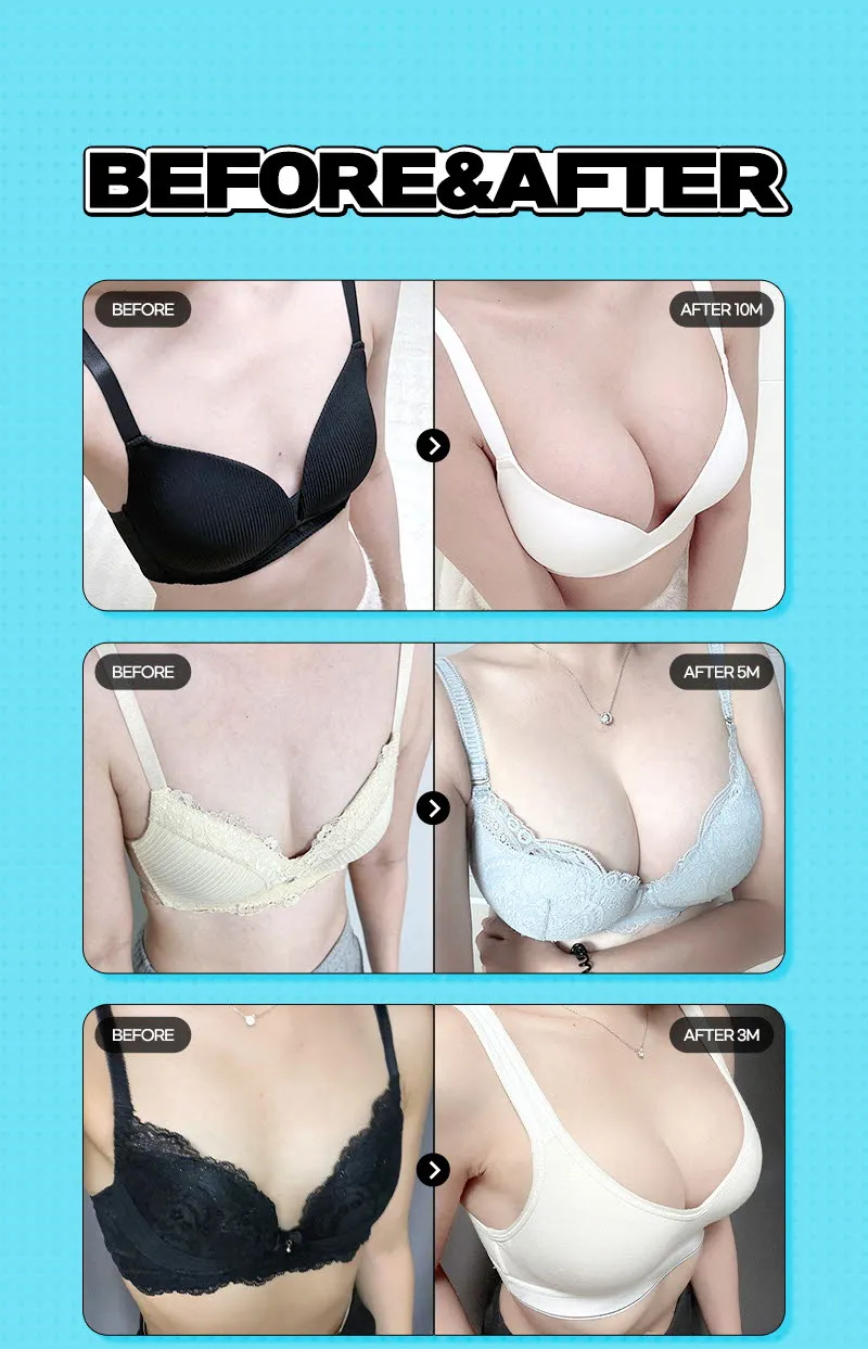 뷰성형외과 ❤️뷰❤️세빈 가슴성형 이벤트, 시술 상세 이미지