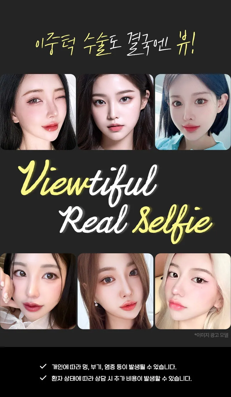 뷰성형외과 ❤뷰❤얼굴 지방흡입 이벤트, 시술 상세 이미지