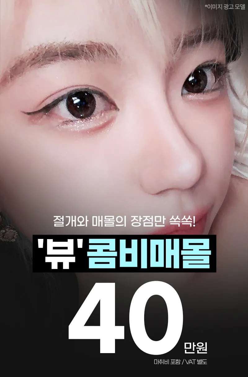뷰성형외과 ❤️뷰❤️눈성형 이벤트, 시술 상세 이미지