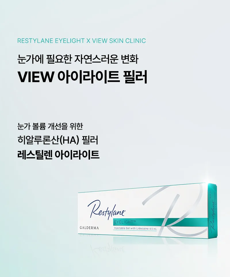 뷰성형외과 ❤️뷰❤️ 아이리프팅 이벤트, 시술 상세 이미지