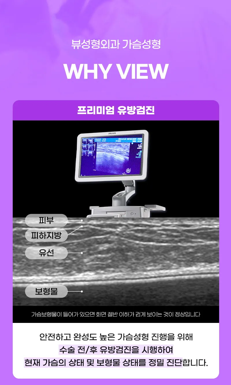 뷰성형외과 ❤뷰❤모티바 가슴 재수술 이벤트, 시술 상세 이미지