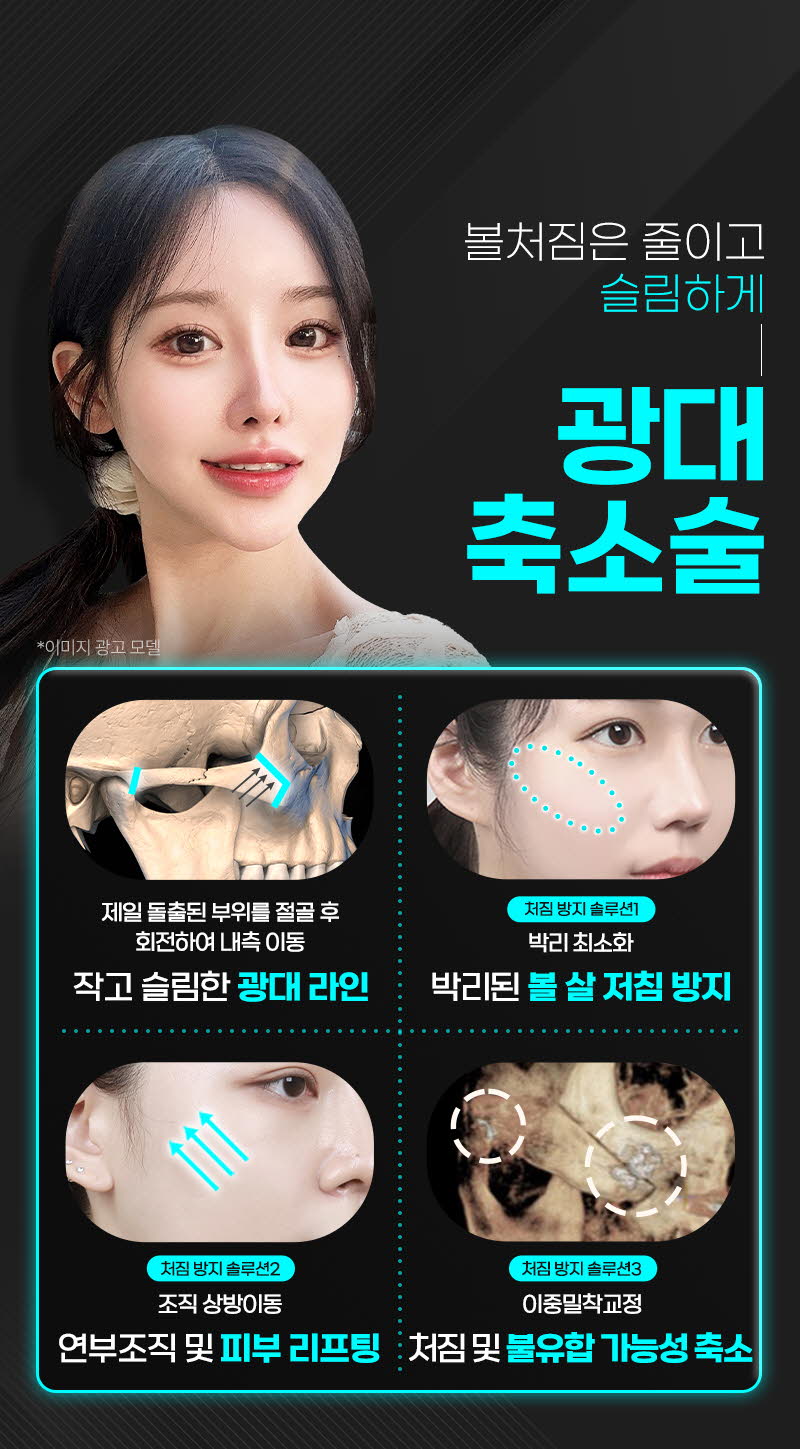 뷰성형외과 ❤️뷰❤️안면윤곽 이벤트, 시술 상세 이미지