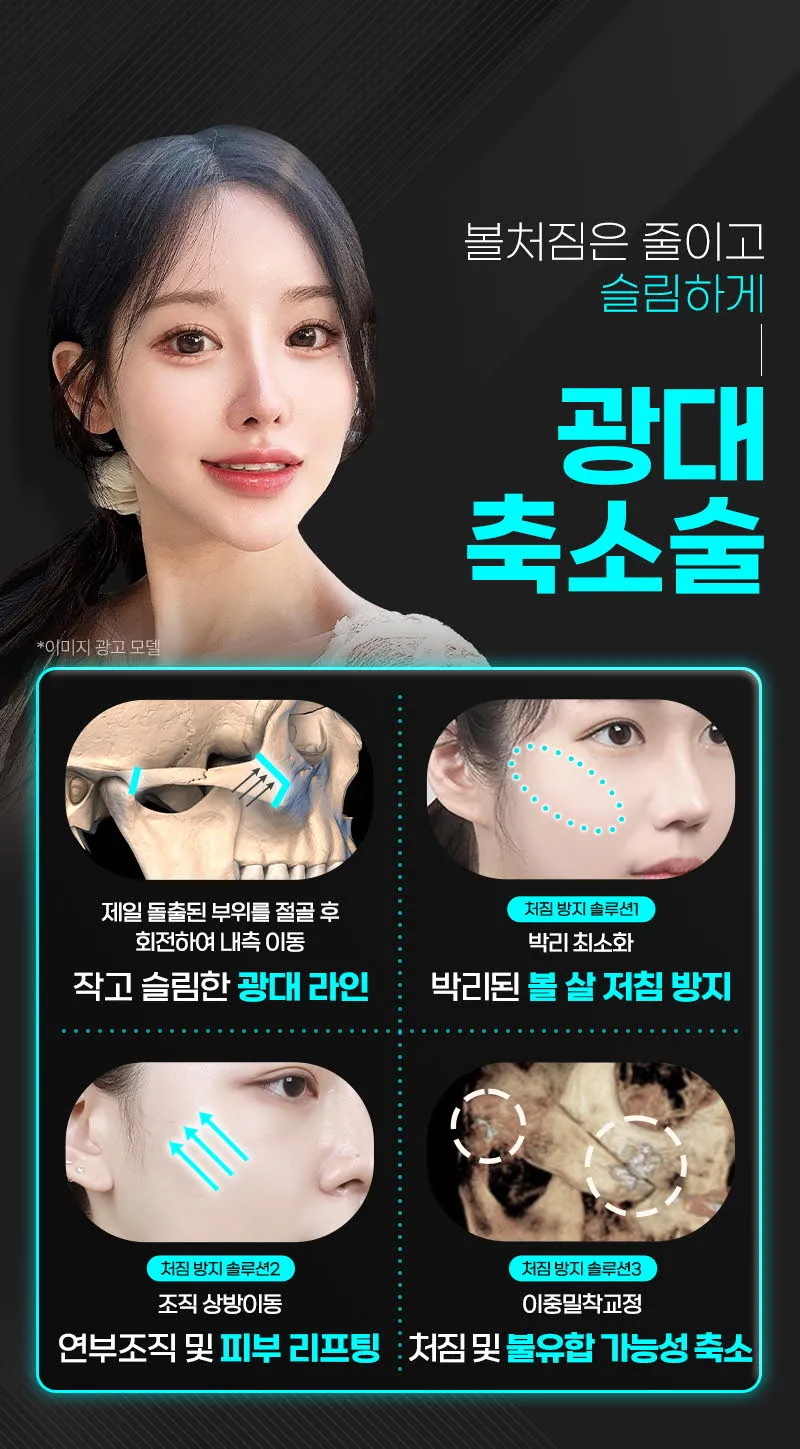 뷰성형외과 ❤️뷰❤️안면윤곽 이벤트, 시술 상세 이미지